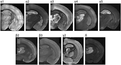 Region and layer-specific expression of GABAA receptor isoforms and KCC2 in developing cortex